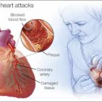 Menopausal hormone may help reducing risk of heart failure