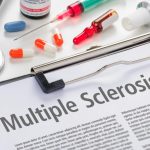 multiple sclerosis