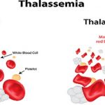 World Thalassemia Day India is in worse condition