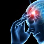 Smartphone app to reduce migraine, Migraine, App to manage Migraine