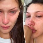 Model Bella Hadid’s Mental Health Struggles