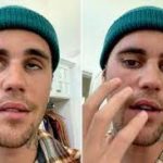 Justin Bieber Half Face Paralyzed After Virus Attack Instagram Video Goes Viral World Tour 2022 Cancel