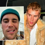 Justin Bieber Half Face Paralyzed After Virus Attack Instagram Video Goes Viral World Tour 2022 Postponed