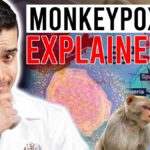 Monkeypox Mortality Rate